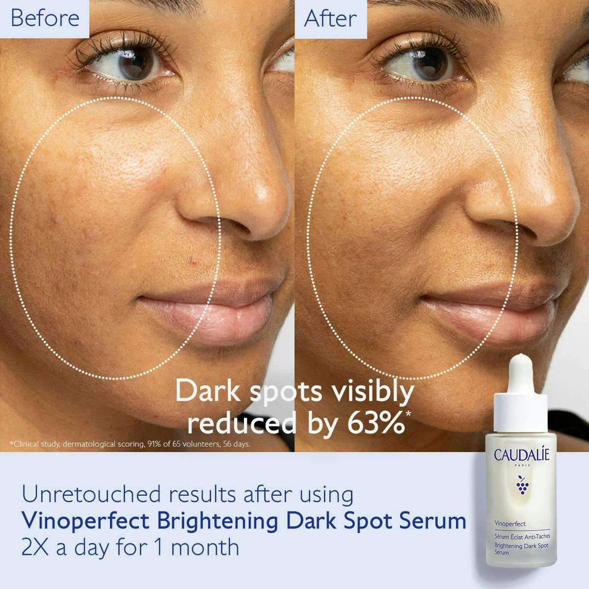 Brightening Dark Spot Serum Vitamin C Alternative - Jumbo
