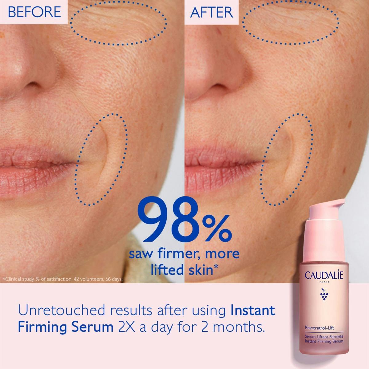 Instant Firming Retinol Alternative Serum - Refill
