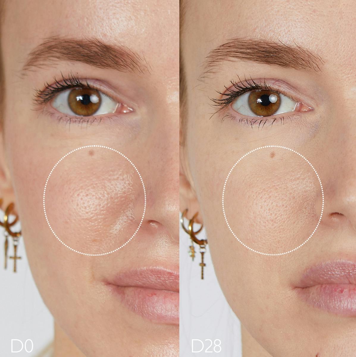 Natural Salicylic Acid Pore Minimizing Toner